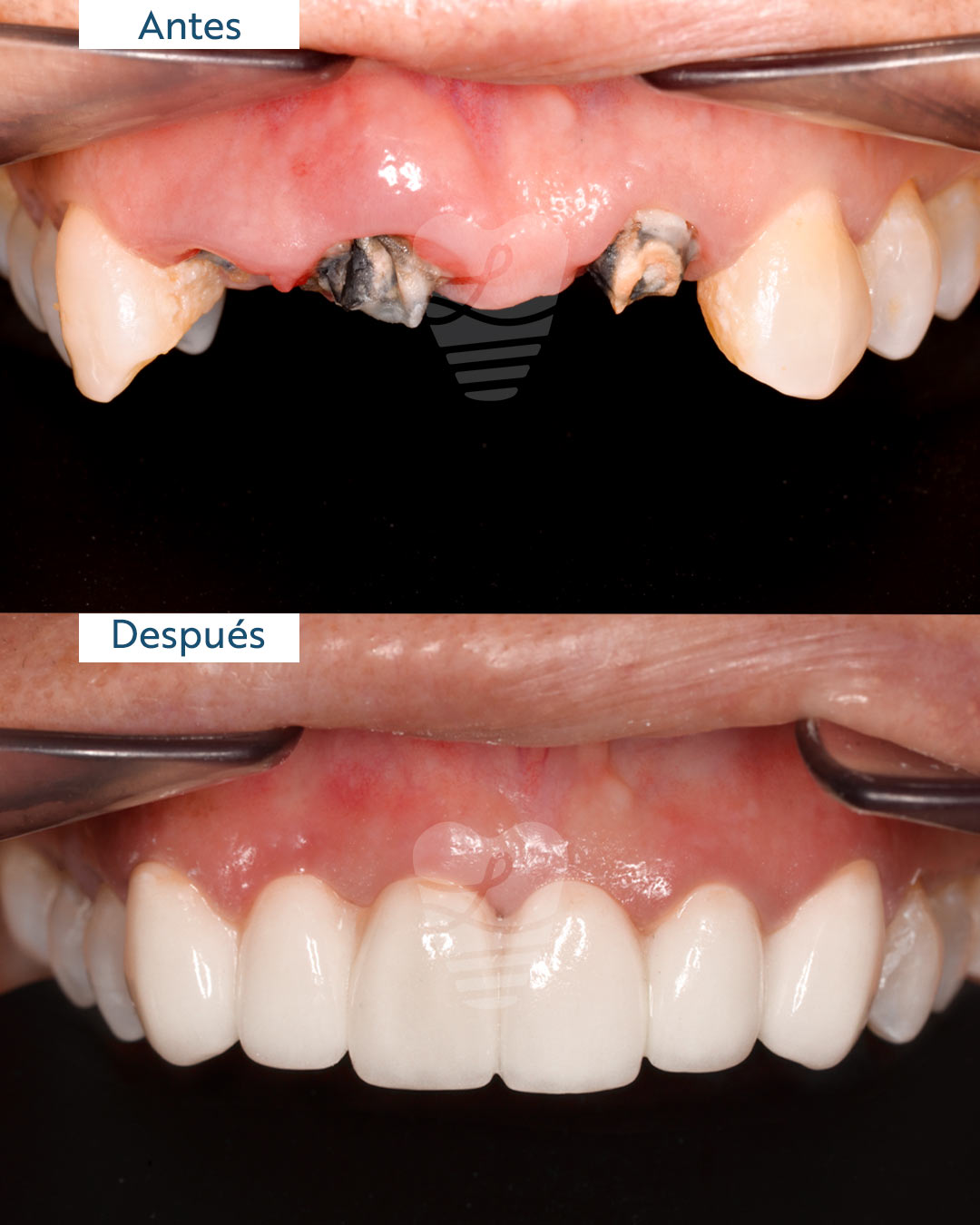 el-antes-y-despues-de-una-sonrisa